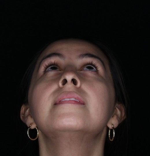 Antes